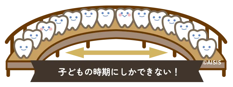 非抜歯矯正